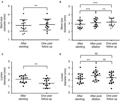 Outcome of Wingspan Stent Using Aggressive Post-stent Balloon Dilation for Intracranial Atherosclerosis Stenosis